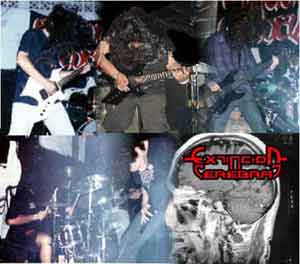 EXTINCION CEREBRAL